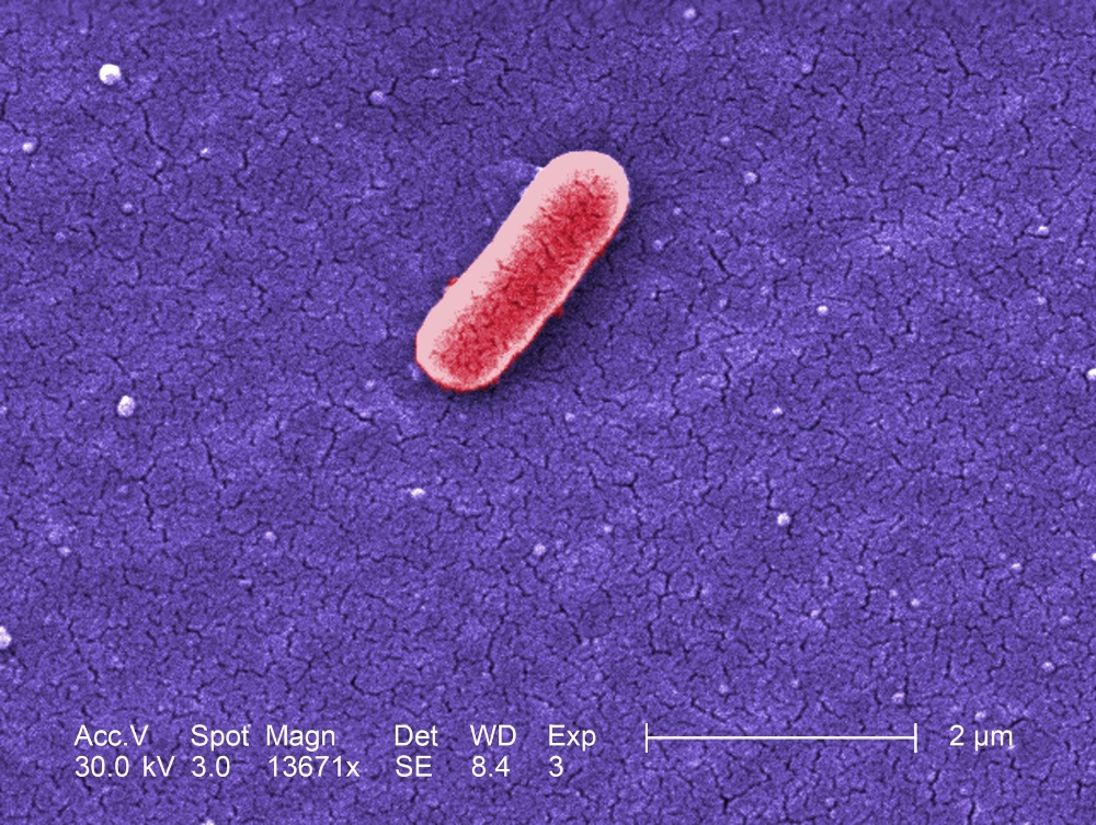 여름철 불청객 ‘세균성 설사’, 원인과 예방법은?