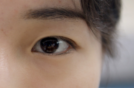 자외선 극심한 여름철 ‘백내장’ 주의