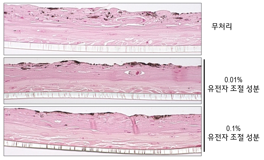 LG생활건강, 한국인의 피부 색소 침착에 관여하는 유전자 발견
