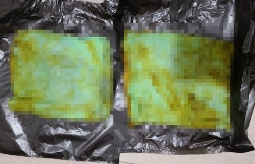 환자 신체에서 나온 배변 패드 조각.(사진=연합뉴스)