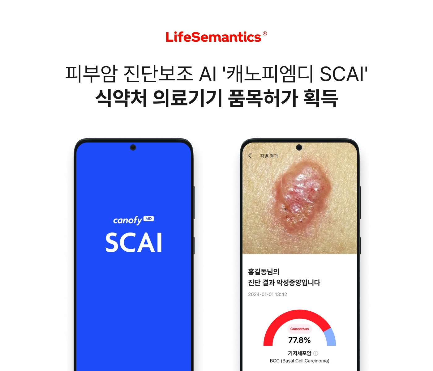 라이프시맨틱스, ‘캐노피엠디 SCAI’ 식약처 품목허가 획득