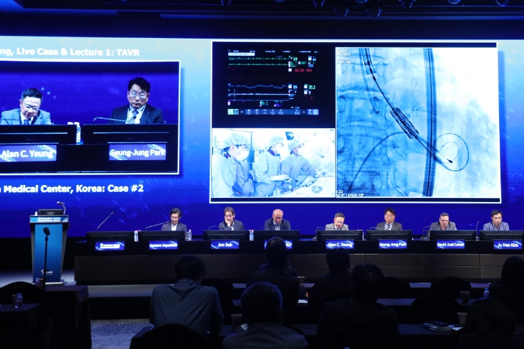 서울아산병원, 제13회 심장판막 및 구조 심질환 중재시술 국제학술회의 개최