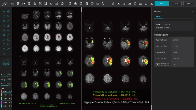 제이엘케이, 뇌관류 MR 영상 분석 솔루션 美 FDA 인허가 신청
