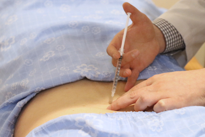 자생한방병원, ‘베르톨로티 증후군’ 한의통합치료 효과 분석