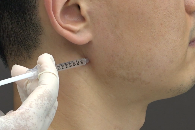 자생한방병원, 만성턱관절질환에 대한 자하거 약침 경제성 평가