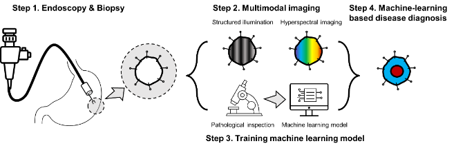 아주대 연구팀이 연구해온 초분광 영상 기술을 통한 위암 진단 모식도. 사진=아주대