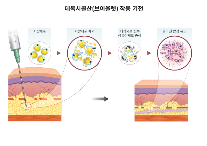 대웅제약 브이올렛 ‘DCA’, 팔뚝 피하지방 7.49mm 줄여