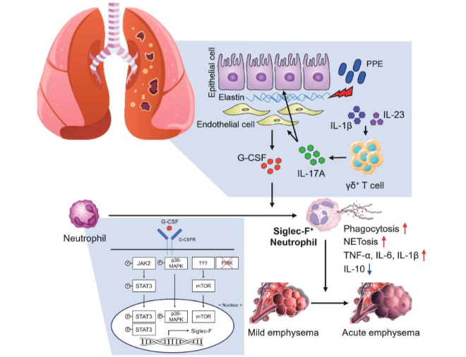 성균관대 배용수 교수 연구팀, 폐 특이적 병원성 호중구 발견