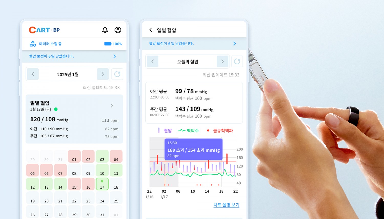 스카이랩스, 개인용 반지형 혈압계 ‘카트 비피(CART BP)’ 선보여