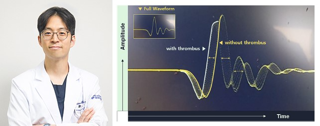 분당차병원 임공민 교수팀, ‘ECMO 혈전 조기 검출’ 한국연구재단 중견연구 과제 선정