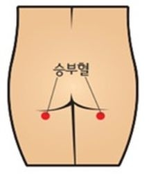 (사진 =경희의료원)