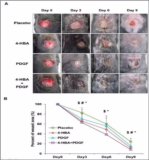 4-HBA 물질이 마우스의 급성상처 치유에 기여하는 정도(사진=연세세브란스병원)
