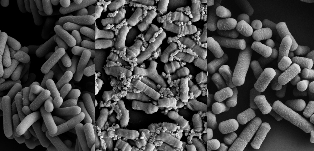한국야쿠르트 특허 유산균 MPRO3, 세계소화기학회서 임상연구 결과 발표