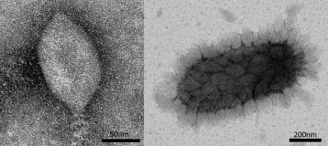 해양 고세균 감염 바이러스 (사진=한국연구재단)