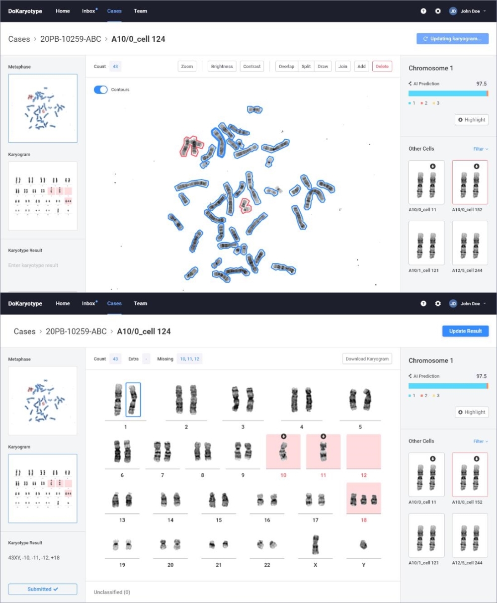 GC녹십자의료재단, 두에이아이와 ‘염색체 정렬 및 판독 인공지능 솔루션’ 공동개발
