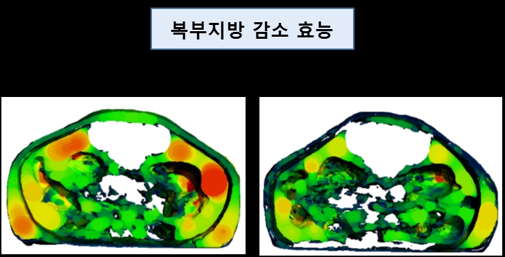 셀리버리, 먹는 고도비만/제2형당뇨병 캡슐신약 개발 본격 진입