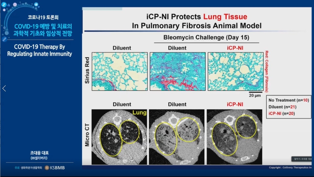 셀리버리, “코로나19 이전 일상으로 돌아가는데 3년 소요”