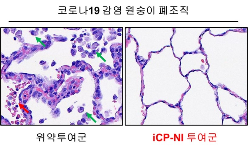 셀리버리, 코로나19 치료제 영장류시험 분석종료 및 최종보고서 수령…코로나19 완치
