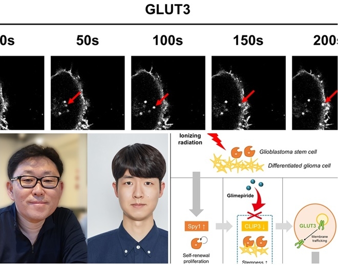 실시간 세포 관찰 시스템 이미지/교모세포종에서 방사선 치료 후 살아남은 교모세포종 암줄기세포(Glioblastoma stem cell)가 CLIP3를 하향조절함에 따라 포도당 대사 활성을 증가시켜 방사선저항성을 유도하는 과정, 글리메피리드는 이러한 CLIP3의 발현을 회복시킴으로써 암줄기세포를 선택적으로 제어할 수 있음/윤부현 교수·강현구 박사과정생.(사진제공=부산대학교)