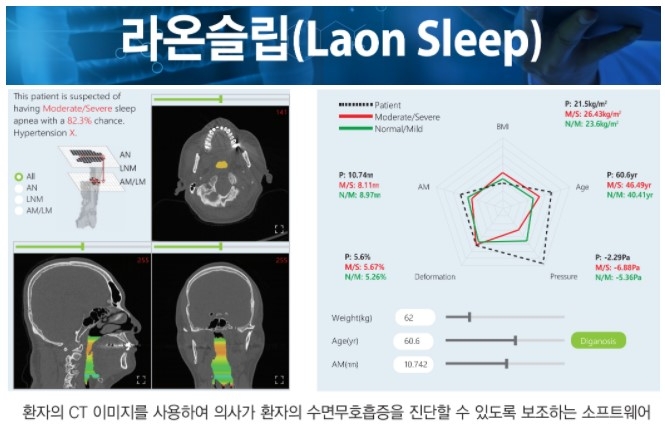 라온피플, 국제의료기기 전시회서 ‘AI 영상진단소프트웨어’ 시연