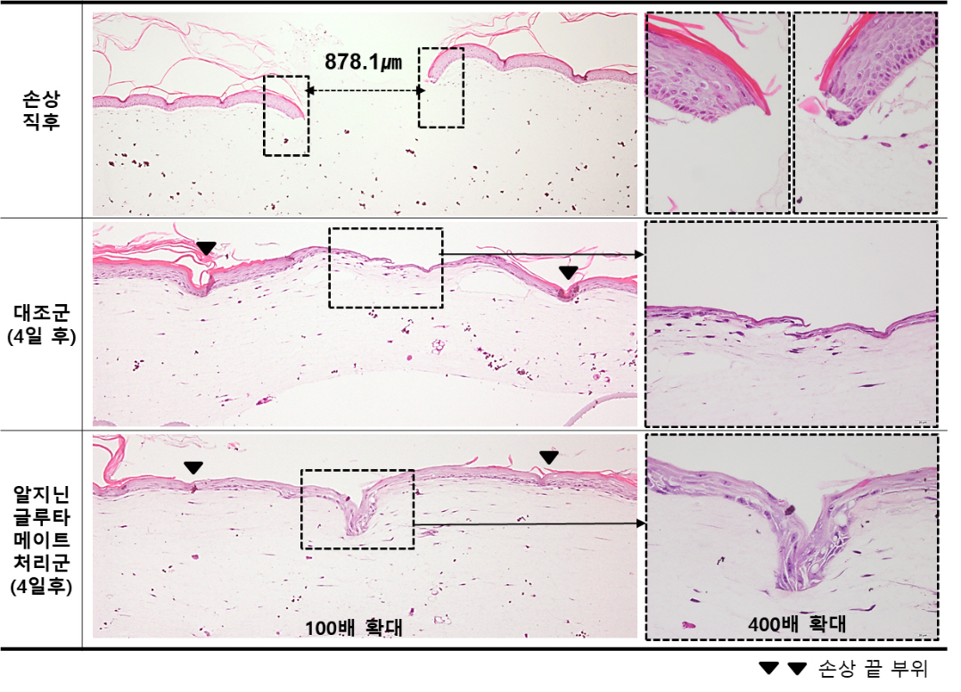 LG생활건강 “아미노산 이온 결합 신소재, 화상 환자의 피부 회복에 효과”