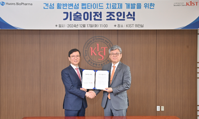 휴온스바이오파마, KIST와 ‘건성 황반변성 점안제 개발’ 협약 체결