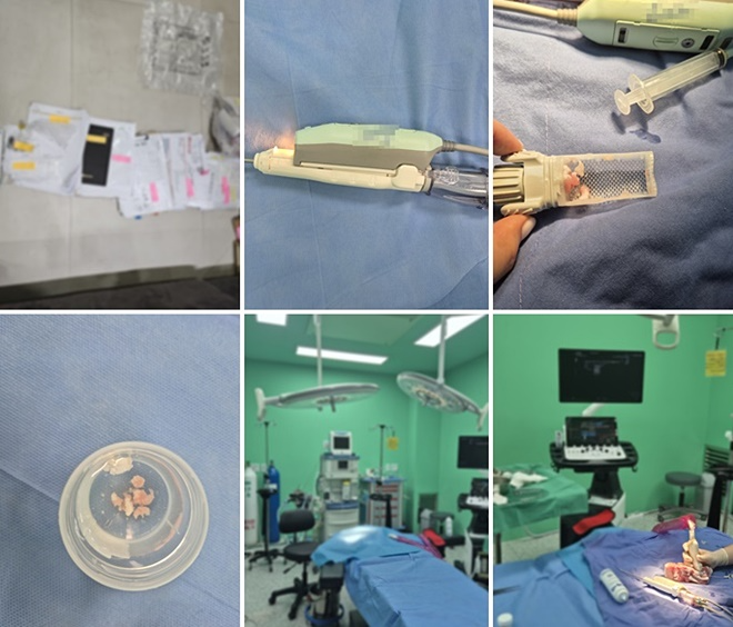 범행관련장부/맘모통 기계로 종양제거 시연/수술실 및 수술재연 모습.(제공=부산경찰청)